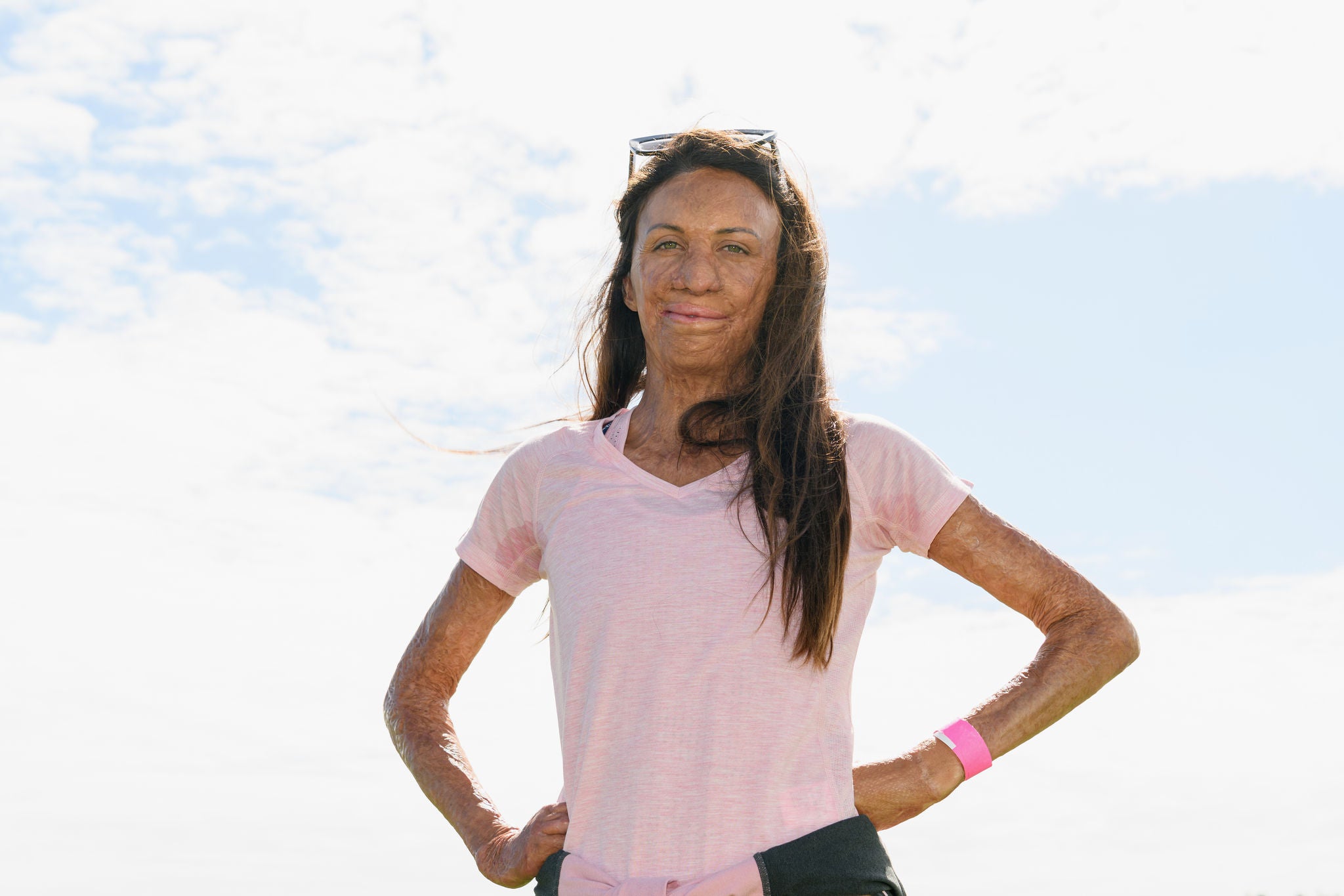 KUMARA, NEW ZEALAND - FEBRUARY 07: Burns survivor Turia Pitt poses during a media opportunity prior to the 2019 Kathmandu Coast to Coast on February 07, 2019 in Kumara, New Zealand. (Photo by Kai Schwoerer/Getty Images)